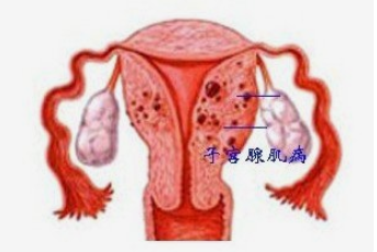 深圳代孕谁做过，深圳第三代试管婴儿成功率高吗？