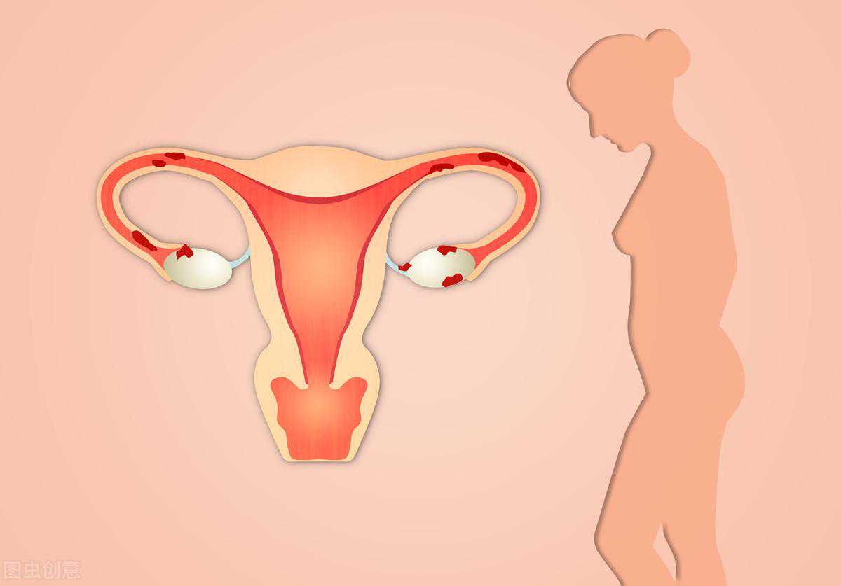 为何子宫内膜会变薄？帮你找出了3个诱因，要反思一下